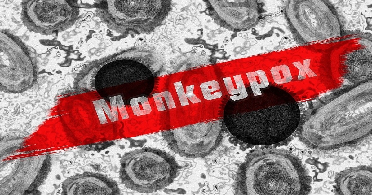 Toronto Confirms Another Suspected Case Of Monkeypox