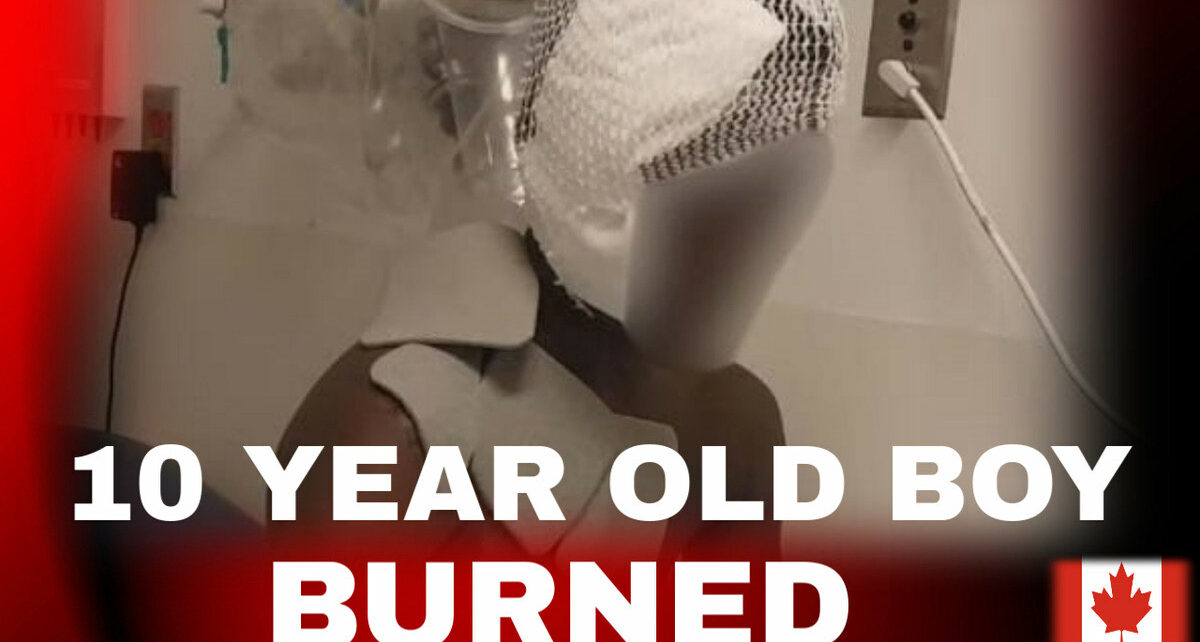 10 Year Old Black Boy Severely Burned In Boiling Hot Water Assault By a White Woman 387 image_123650291 (17)