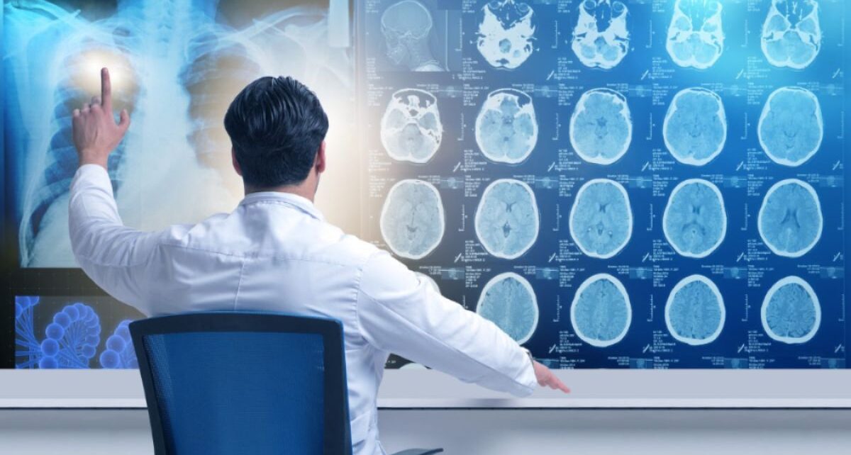 AI in Medical Imaging Market is estimated to be valued at US$ 9.60 Bn in 2031 32 AI in Medical Imaging Market
