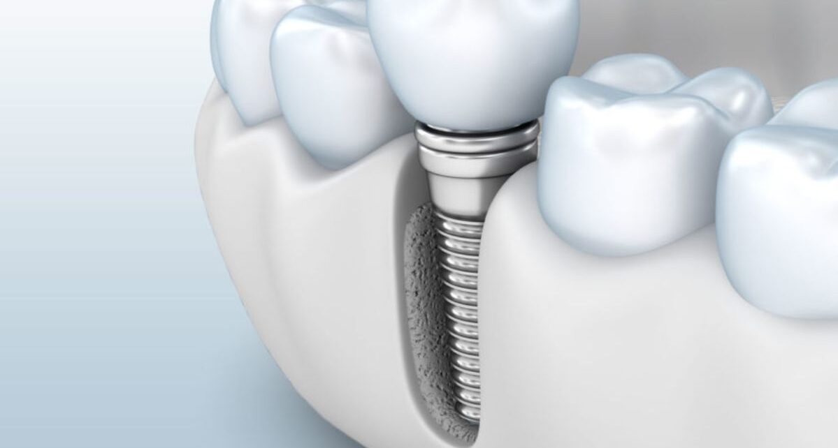 Bone Morphogenetic Protein Market