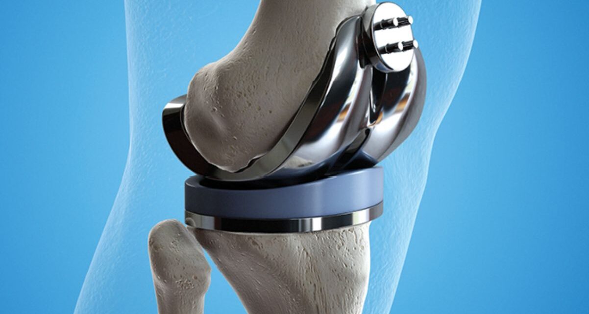 Orthopedic Devices Market Is Estimated To Witness High Growth Owing To Rising Geriatric Population 1 Orthopedic Devices Market