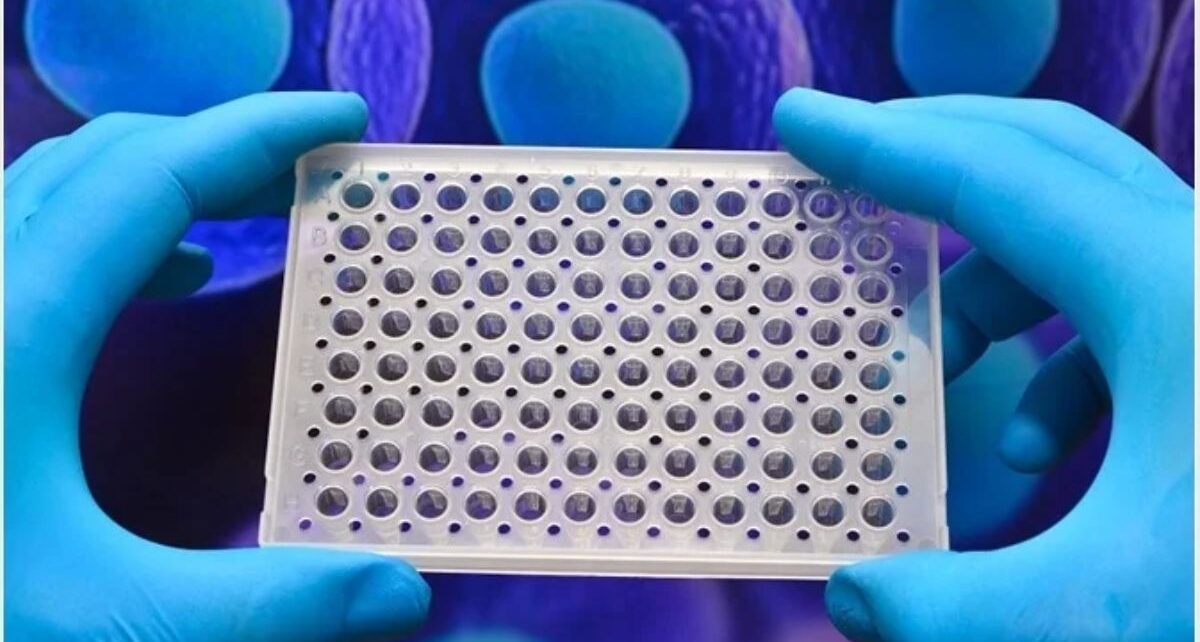 Protein Chip Market