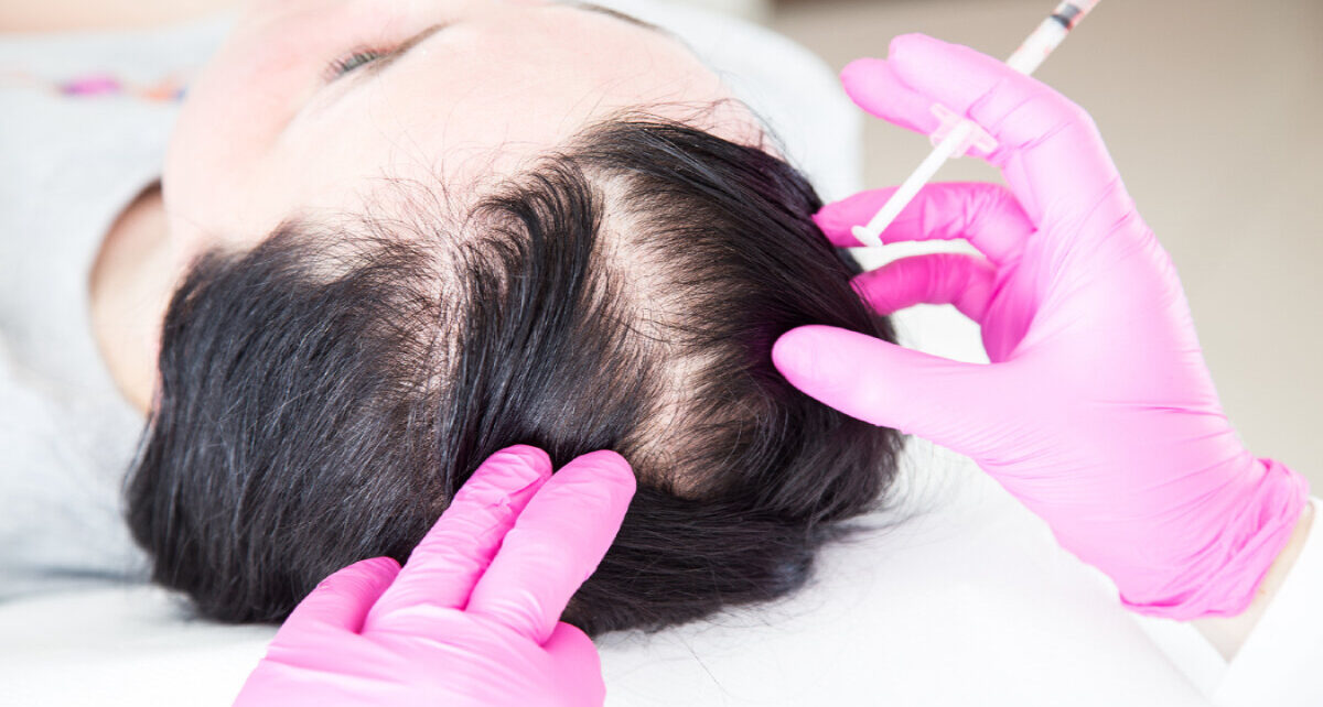 Scalp Microneedling Market