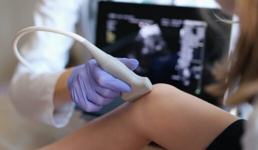 Cascade-Health-446146-Doppler-ultrasound-knee-image1
